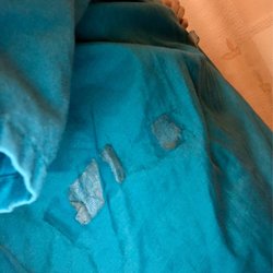New Jersey Imaging Network of Haddon Heights - More tape on my "clean gown"