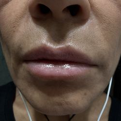 Lips
