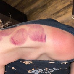 Chinese Massage Therapy