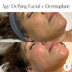Royale European Skin Care - Age Defying Facial & Dermaplane