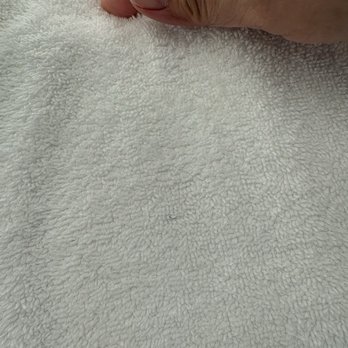 Hilton Anaheim - Dirty and stained towels - Hotels Near Me - Anaheim, California