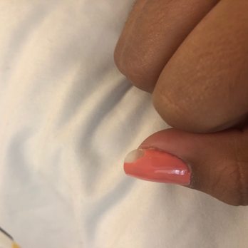 Coco Nails & Spa - Chipped gel manicure after 2 days. - Nail Salons Near Me - North Providence, Rhode Island Coco Nails & Spa - Chipped gel manicure after 2 days. - Nail Salons Near Me - North Providence, Rhode Island