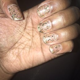 The worst nails I have ever had The worst nails I have ever had