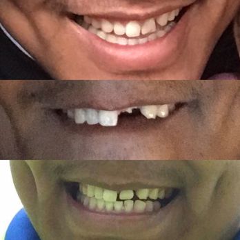Dental World Kapolei - General Dentistry Near Me - Kapolei, Hawaii