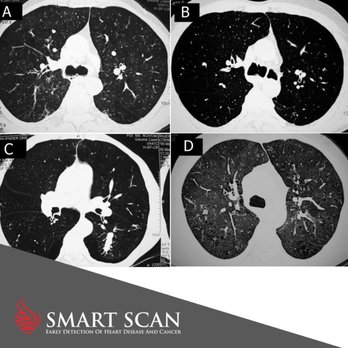 Smart Scan - Cardiologists Near Me - Sarasota, Florida Smart Scan - Cardiologists Near Me - Sarasota, Florida