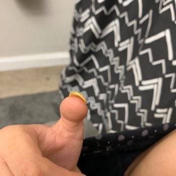 Crystal Nails - crooked nail, one side has less acrylic than the other - Nail Salons Near Me - Orlando, Florida Crystal Nails - crooked nail, one side has less acrylic than the other - Nail Salons Near Me - Orlando, Florida