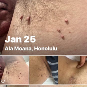 Queen Beauty - Skin tags removed - Waxing Near Me - Honolulu, Hawaii