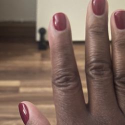 Nail Project - Swollen finger!
