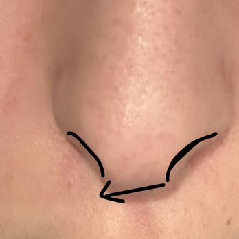 Arash Moradzadeh, MD - Ear Nose & Throat Near Me - Beverly Hills, California