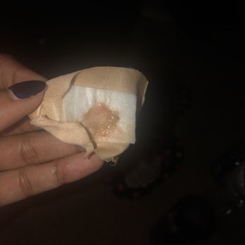 Nail Trix - This is the stuff oozing out of my toe nail - Nail Salons Near Me - Bowie, Maryland Nail Trix - This is the stuff oozing out of my toe nail - Nail Salons Near Me - Bowie, Maryland