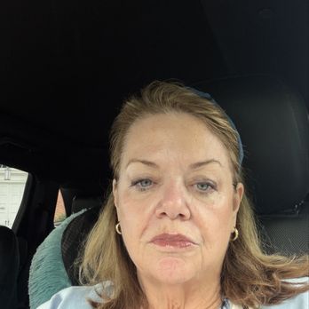 AMG Plastic Surgery - Me at 65 years old after my Tri-lift, Sculptra, and some filler. - Plastic Surgeons Near Me - Herndon, Virginia