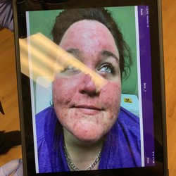 NORTH ATLANTA DERMATOLOGY - 15 Photos & 79 Reviews - 3850 Pleasant Hill