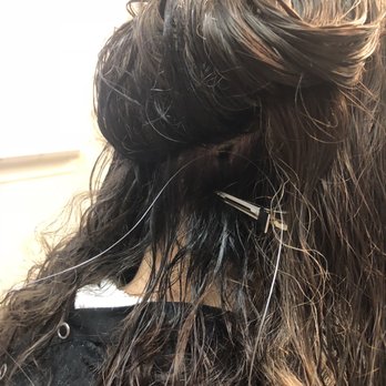 Personal Image - Point technique for attachment - Hair Loss Centers Near Me - Needham, Massachusetts Personal Image - Point technique for attachment - Hair Loss Centers Near Me - Needham, Massachusetts