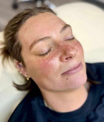 Permanent Makeup - Cosmetic tattooing or permanent makeup enhances brows or lash lines, creating a fuller, more complete look.
