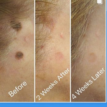 Carniol Plastic Surgery - Plastic Surgeons Near Me - Summit, New Jersey