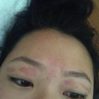 Unique Threading and Body Wax - The burn from the wax. Has never happened to me in the 4+ years I've been getting my brows waxed. - Sugaring Near Me - Atlanta, Georgia Unique Threading and Body Wax - The burn from the wax. Has never happened to me in the 4+ years I've been getting my brows waxed. - Sugaring Near Me - Atlanta, Georgia