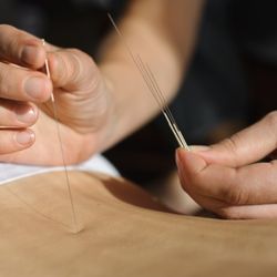Thai Oasis - Acupuncture for pain relief and disorders