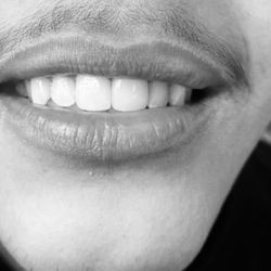 Lovik Mirzaeian, DDS - Aftermath