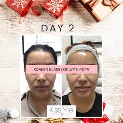 Kiss Me Med Spa - Glass Skin Facial