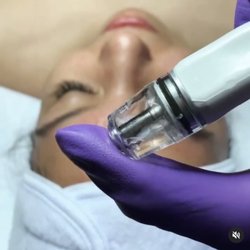 Pure Radiance Aesthetics - Dermalinfusion