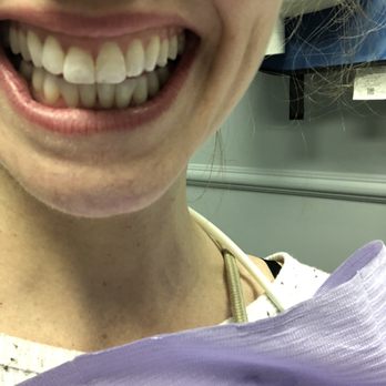 New Jersey Dental Arts - Big smile for a nice clean mouth after my cleaning - thanks Liz and dr Rahagi! - General Dentistry Near Me - Bloomfield, New Jersey