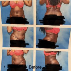 Robert Frank, MD Plastic Surgery - Before