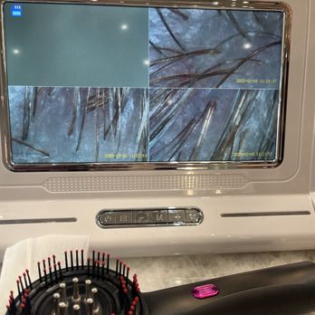 Scalp Bar - Your provided before and after picture of your scalp. This is after my treatments. - Hair Salons Near Me - Las Vegas, Nevada Scalp Bar - Your provided before and after picture of your scalp. This is after my treatments. - Hair Salons Near Me - Las Vegas, Nevada
