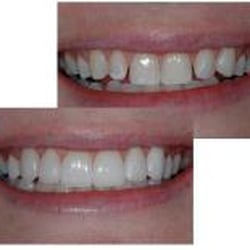Stephen J Rubinkan, DDS APC - San Diego Dentist Dr. Stephen Rubinkan can create your beautiful new smile in just one day!