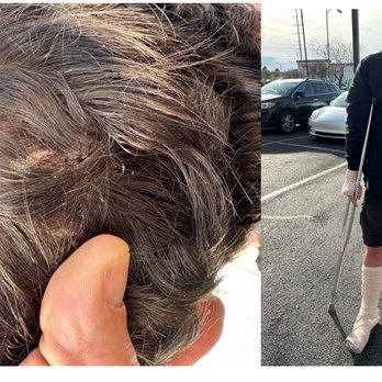 Jack Bernstein, Injury Attorneys - Personal Injury Law Near Me - Tampa, Florida Jack Bernstein, Injury Attorneys - Personal Injury Law Near Me - Tampa, Florida