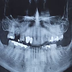 Greenberg Dental & Orthodontics - Before