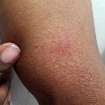 Sleep Inn Henderson I-85 - Bites from BEDBUGS on my mother - Hotels Near Me - Henderson, North Carolina