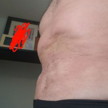 Sono Bello - Cosmetic Surgeons Near Me - Orlando, Florida