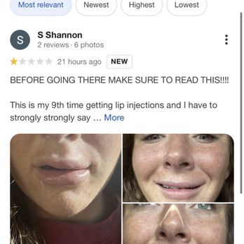 MedifaceSpa - TERRIBLE DO NOT EVER GO THERE!!!!!!! I posted this on my YouTube channel last night, reaching over 600,000 views by this morning!!! - Medical Spas Near Me - Naples, Florida