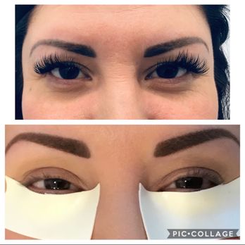 Barry Kusman, MD, FACS - Before & After - Skin Care Near Me