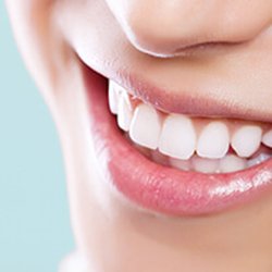 Teeth Whitening..
Give us a call
