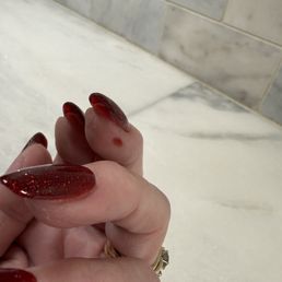 Polish on my finger and my nail filed incorrectly Polish on my finger and my nail filed incorrectly