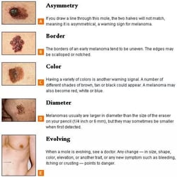 Always Young Skin Care - Good information no matter what your age is.