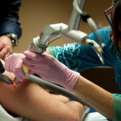Removery Tattoo Removal & Fading