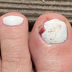 Nails Studio - Injury to my done at nails studio in Rome ga