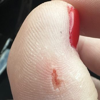 Castle Nail Spa - The painful chunk taken out of my toe by the scrubber. - Massage Near Me - Southlake, Texas Castle Nail Spa - The painful chunk taken out of my toe by the scrubber. - Massage Near Me - Southlake, Texas
