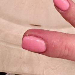 Nails Vision - Pus coming out of my finger the day after getting them done