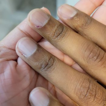 Yeah 1 Nails Bar - Cuticles were cut and bleeding - Nail Salons Near Me - Plano, Texas Yeah 1 Nails Bar - Cuticles were cut and bleeding - Nail Salons Near Me - Plano, Texas