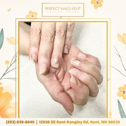 Perfect Nails Kent - Embrace elegance and love with our stunning heart gold nails!