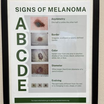 Willamette Valley Dermatology - Helpful information posted in exam room - Dermatologists Near Me - Eugene, Oregon