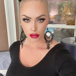 New Radiance Cosmetic Center - St Lucie - Just updates on Karen's work. Radiesse cheek filler, Russian lip flip, full Botox.
