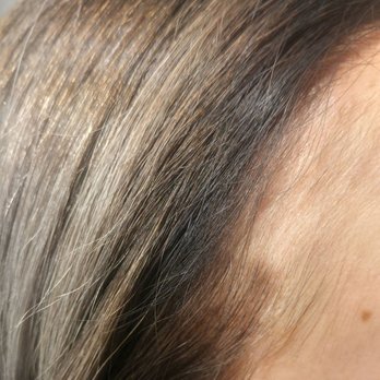 Redness From Irritation And Missed A Patch Of Hair When Applying