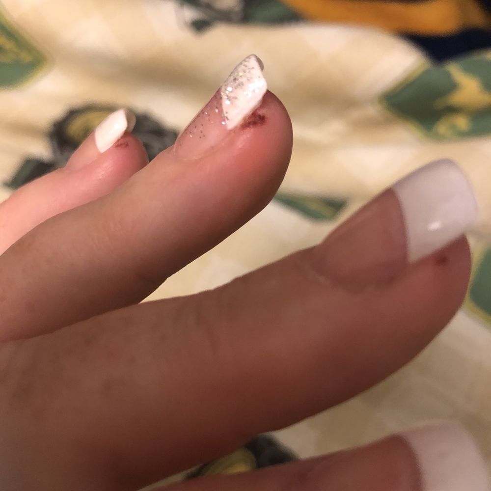 3 fingers in this pic are cut and sore. Ring finger is the worst and is quite deep. 3 fingers in this pic are cut and sore. Ring finger is the worst and is quite deep.