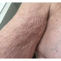 Anti Aging Center of Boca - June 2021