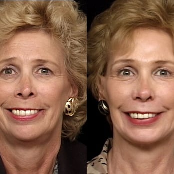 George E. Peck, MD - Cosmetic Surgeons Near Me - West Orange, New Jersey George E. Peck, MD - Cosmetic Surgeons Near Me - West Orange, New Jersey