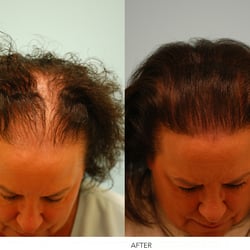 Ava Hair Restoration & Med Spa